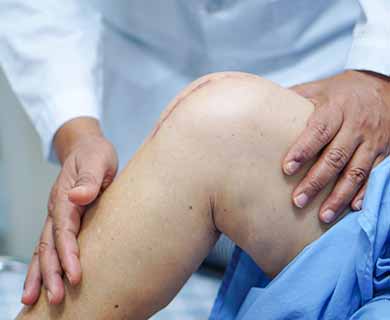 Knee Replacement